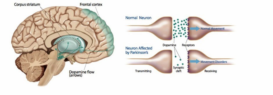 A brain diagram showing neurotransmitter dopamine sending a signal related to pleasure, credit to  Delilah R. Cohn