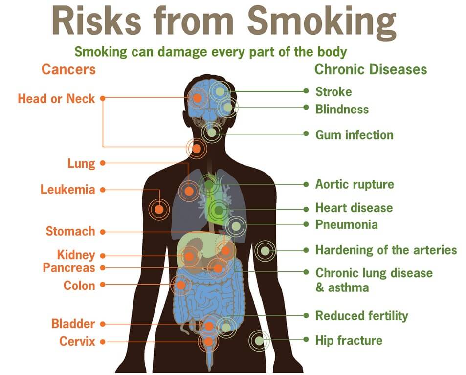 Damage Smoking may Cause Body Diagram VaporPlants