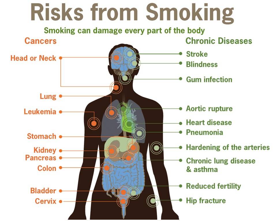 Risks of Smoking